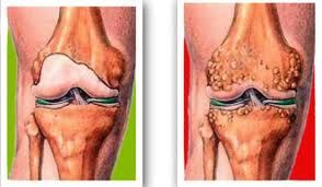 images_54.jpg images_54.jpg